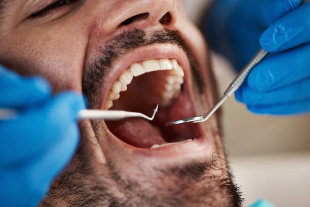 Best Emergency Treatment for Jaw Pain or Injury in Florida, NY